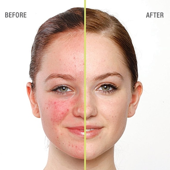 Juice Beauty Blemish Clearing Serum (60ml) - Picture 6 of 8